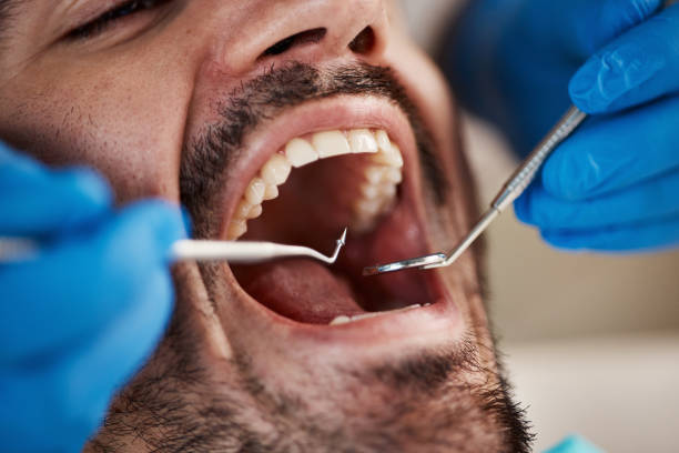 Best Cosmetic Emergency Dentistry in Glade Spring, VA